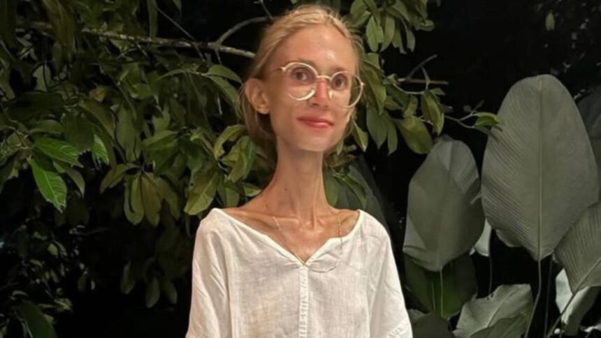 tanara poloneza moarta dupa o dieta extrema bazata doar pe fructe crude avea doar 22 de kilograme 68e9389885898