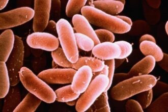 alerta alimentara in romania peste contaminat cu bacteria listeria retras din magazine 692c8d0888c88
