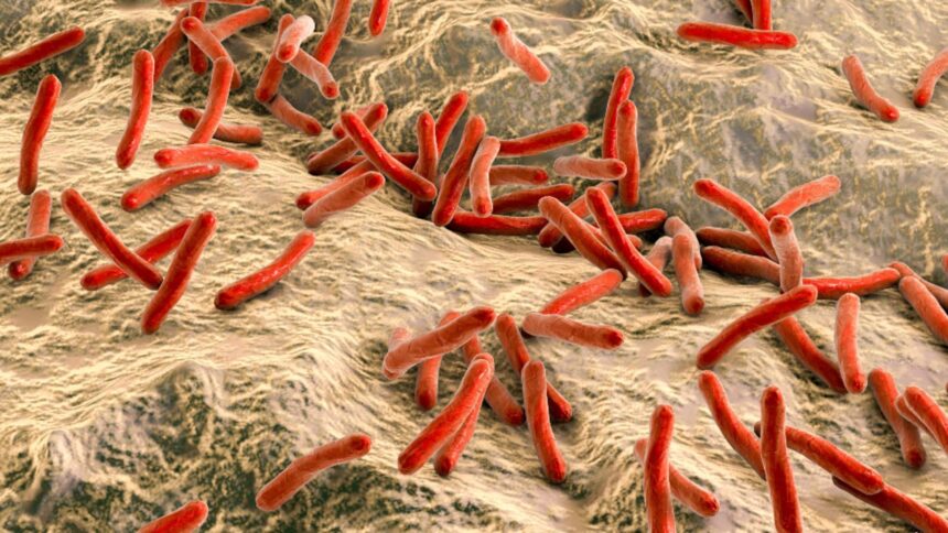 autoritatile din cluj spun ca au sub control situatia cazurilor de lepra nu exista un risc major pentru populatie 69413a67ecfed