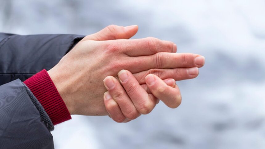 boala ascunsa in spatele spatele mainilor reci semnalul care iti indica ca nu este o reactie normala la frig 69370f953a70a