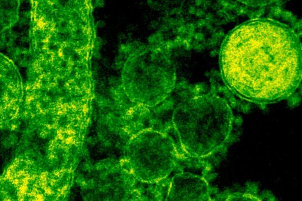 cat de contagioasa este lepra ce spun specialistii 6940053c35aa2