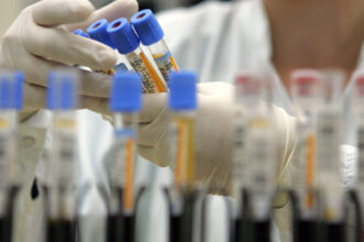 un studiu dezvaluie cele 37 de proteine din sangele centenarilor legate de o viata mai lunga si mai sanatoasa 69aed3ee24b39